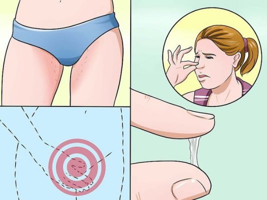 10 dấu hiệu viêm nhiễm vùng kín ở nữ giới