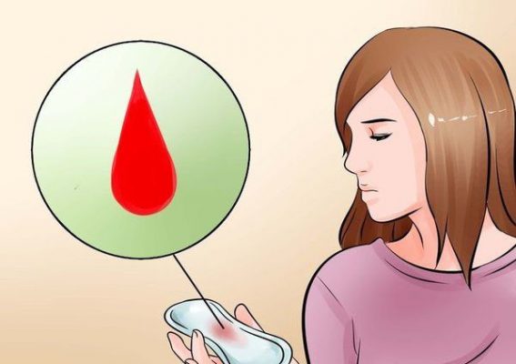 Chảy máu âm đạo bất thường cảnh báo bệnh gì?